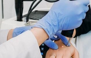 a szemölcsök eltávolításának módjai